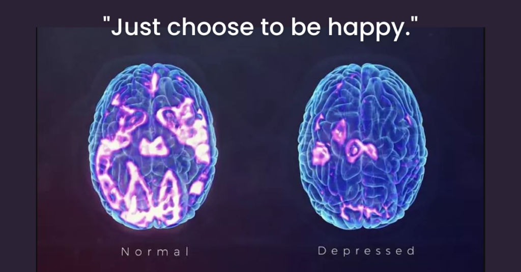 An image of a depressed brain compared to a normal brain